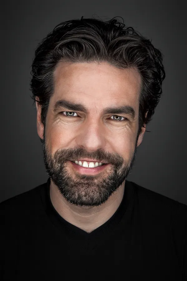 Exosomes-for-Hair-Restoration-Treatment A man with thick, lustrous hair. Get exosomes for hair restoration from Marina Fay, PA-C in Aventura-North Miami.