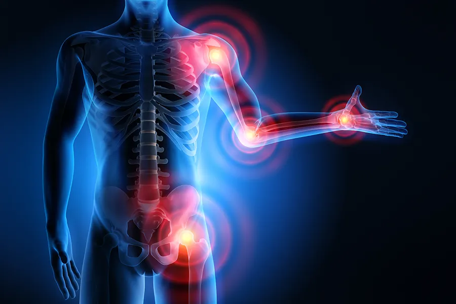 PRP-for-Joint-Pain-Clinic 3D illustration of a human body under x-ray, with highlights on the joints. Get PRP for joint pain from Marina Fay, PA-C in Aventura-North Miami.