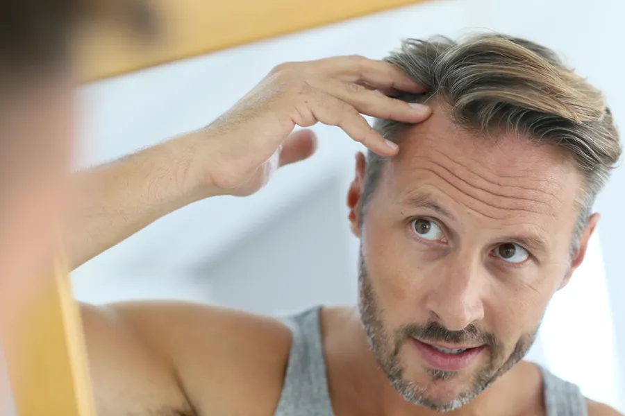 Peptides-for-Hair-Restoration-Doctor A middle-aged man with blonde and gray hair inspects his receding hairline in the mirror, considering getting peptides for hair restoration treatments from Marina Fay, PA-C in Aventura-North Miami.