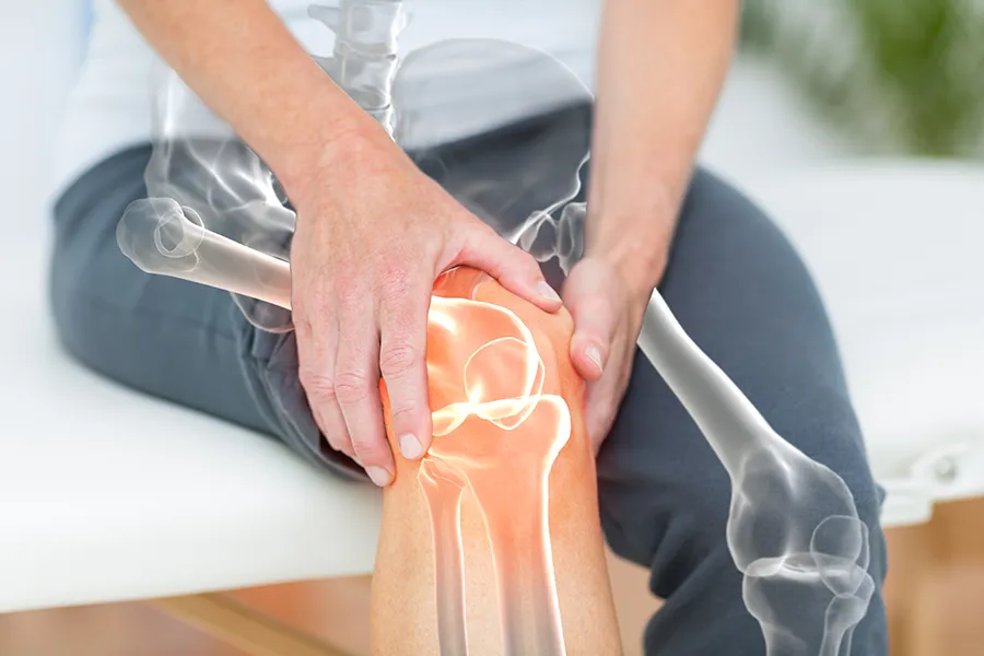Rheumatology-Clinic A woman in exercise clothes holds her knee and an illustrated x-ray of knee pain is overlayed. Get rheumatology services from Marina Fay, PA-C in Aventura-North Miami.